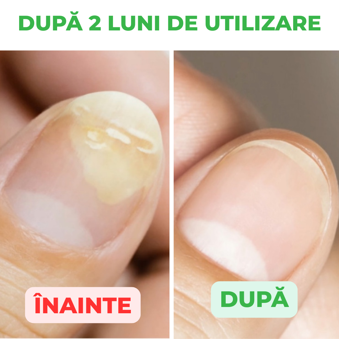 Active Care Solution, Tratament Pentru Unghii si Piele, 30 ml