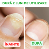 Active Care Solution, Tratament Pentru Unghii si Piele, 30 ml