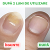Active Care Solution, Tratament Pentru Unghii si Piele, 30 ml